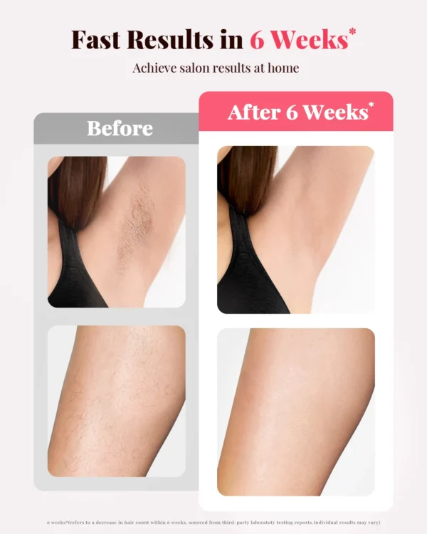 Home IPL Laser Hair Removal – 9 Levels, 3 Modes, Unlimited Flashes, Fast Results - Image 3