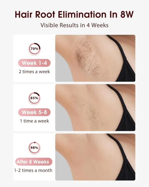 IPL Hair Removal Laser – ICE Cooling, 999900 Flashes, 5 Levels, Permanent & Full-Body - Image 5