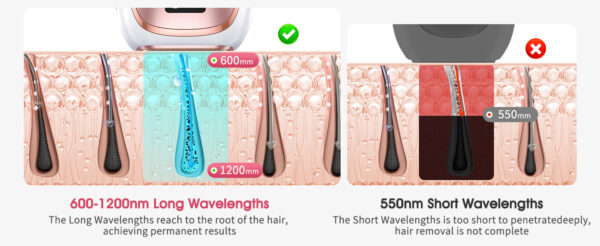 IPL Hair Removal Laser – ICE Cooling, 999900 Flashes, 5 Levels, Permanent & Full-Body - Image 9